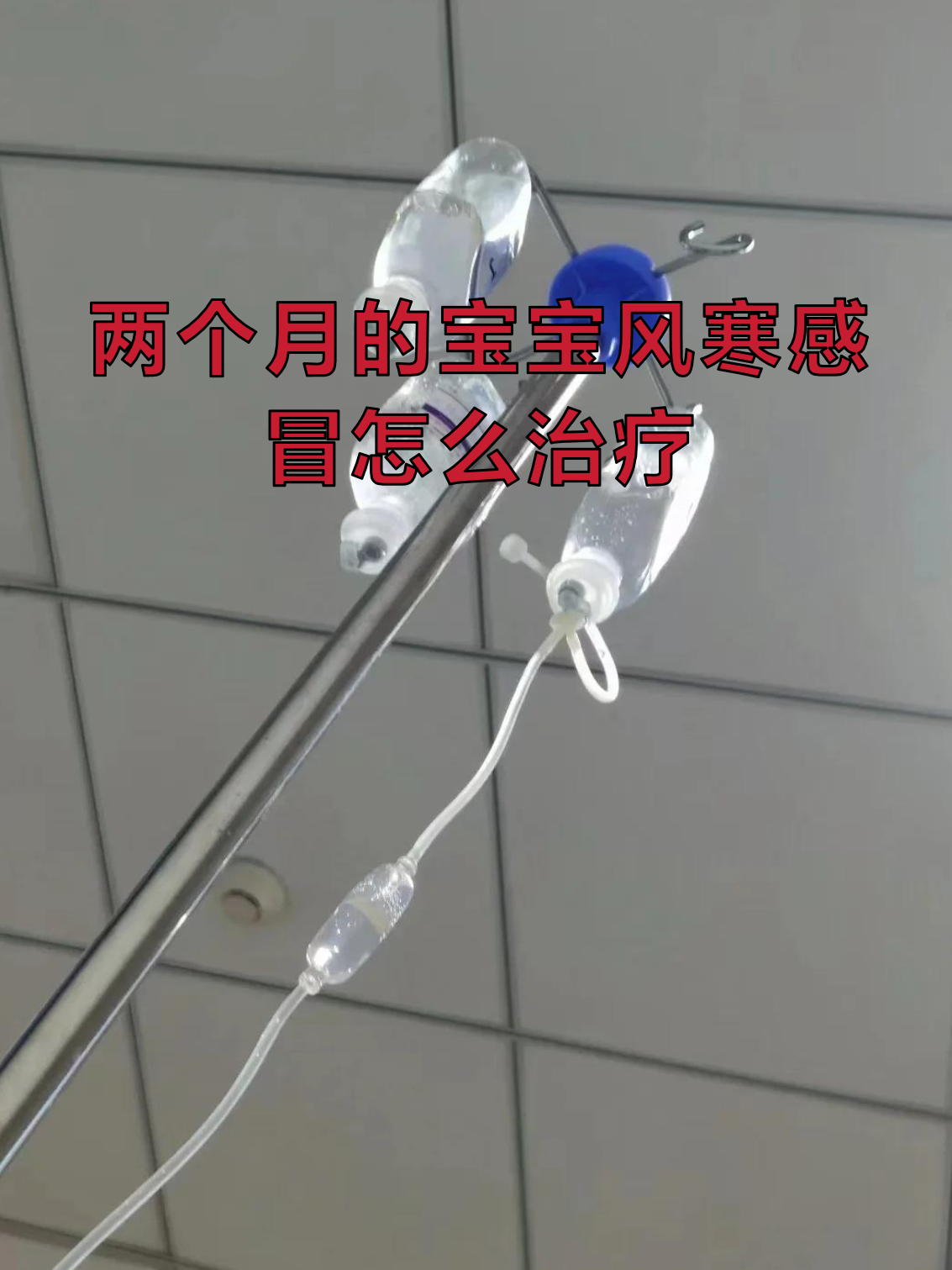 两个月婴儿感冒怎么办