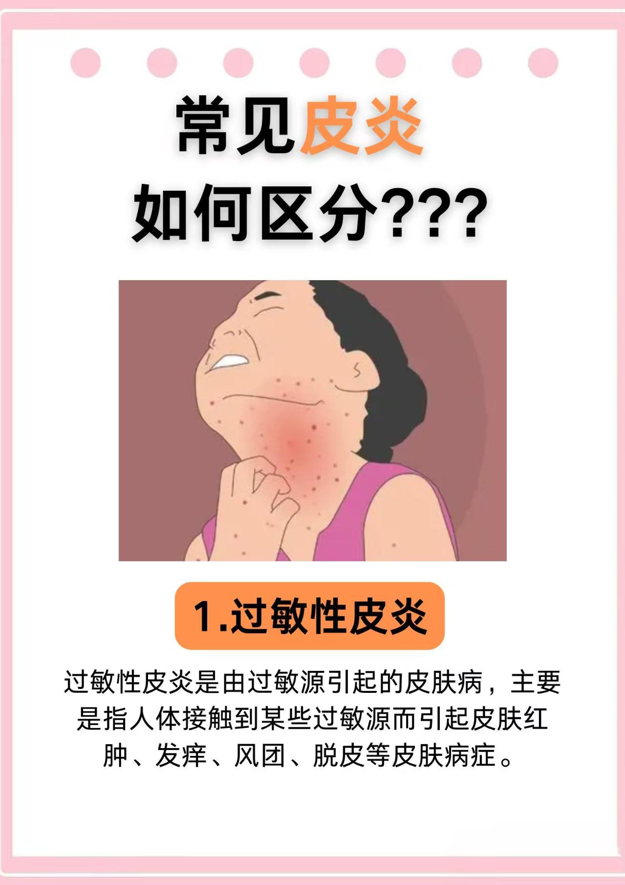 湿疹性皮炎是什么病