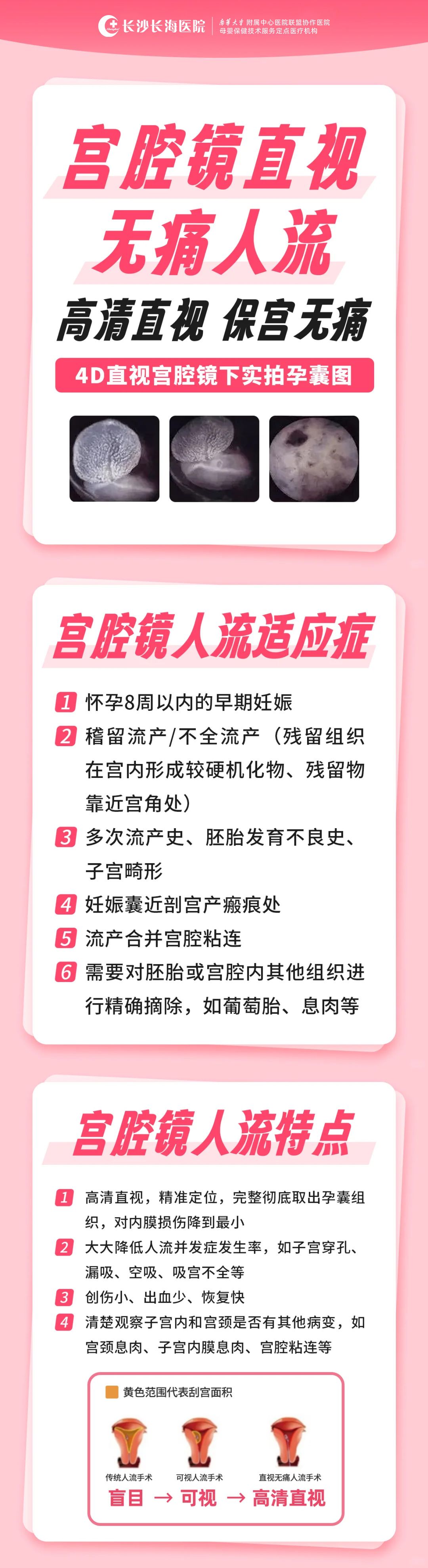 无痛人流的过程是什么?