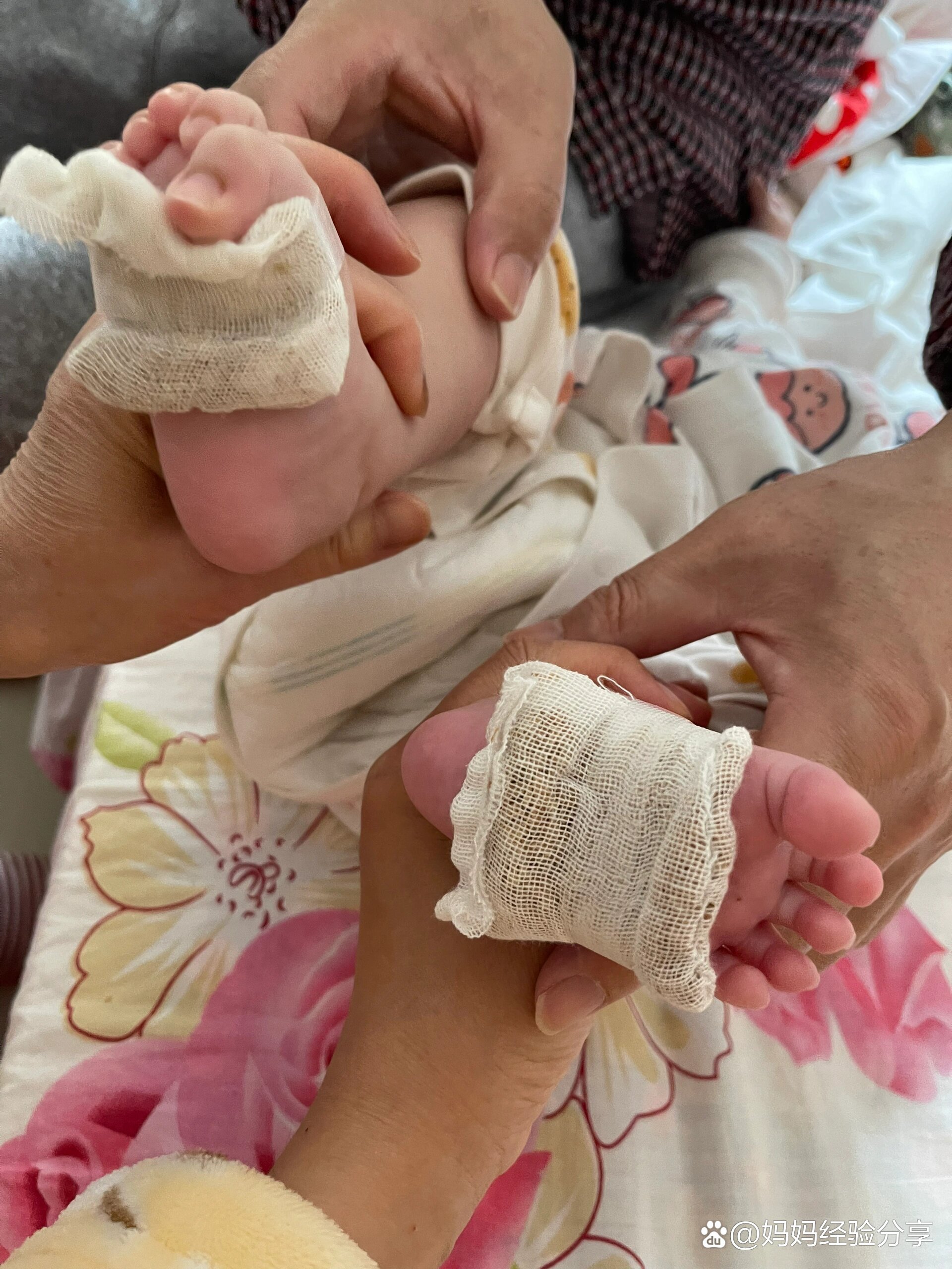 二个月婴儿感冒怎么办