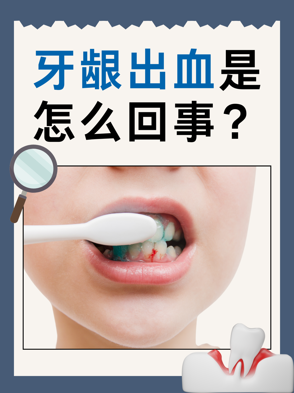 牙龈经常出血?该怎么办?