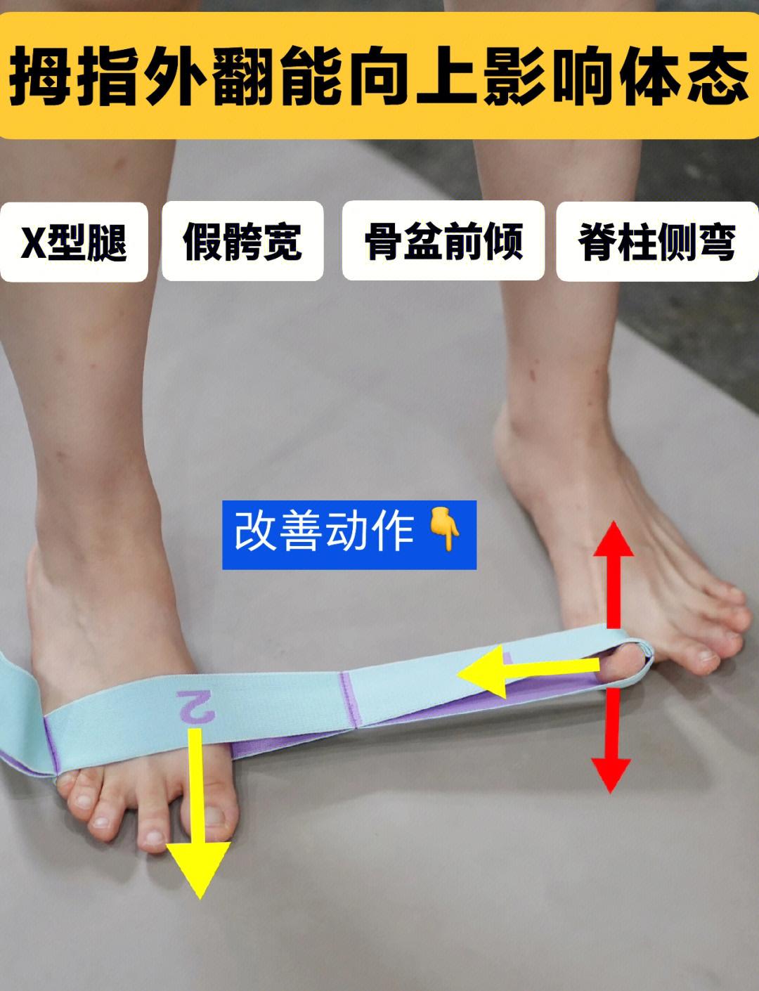 x腿有什么方法可以治疗?