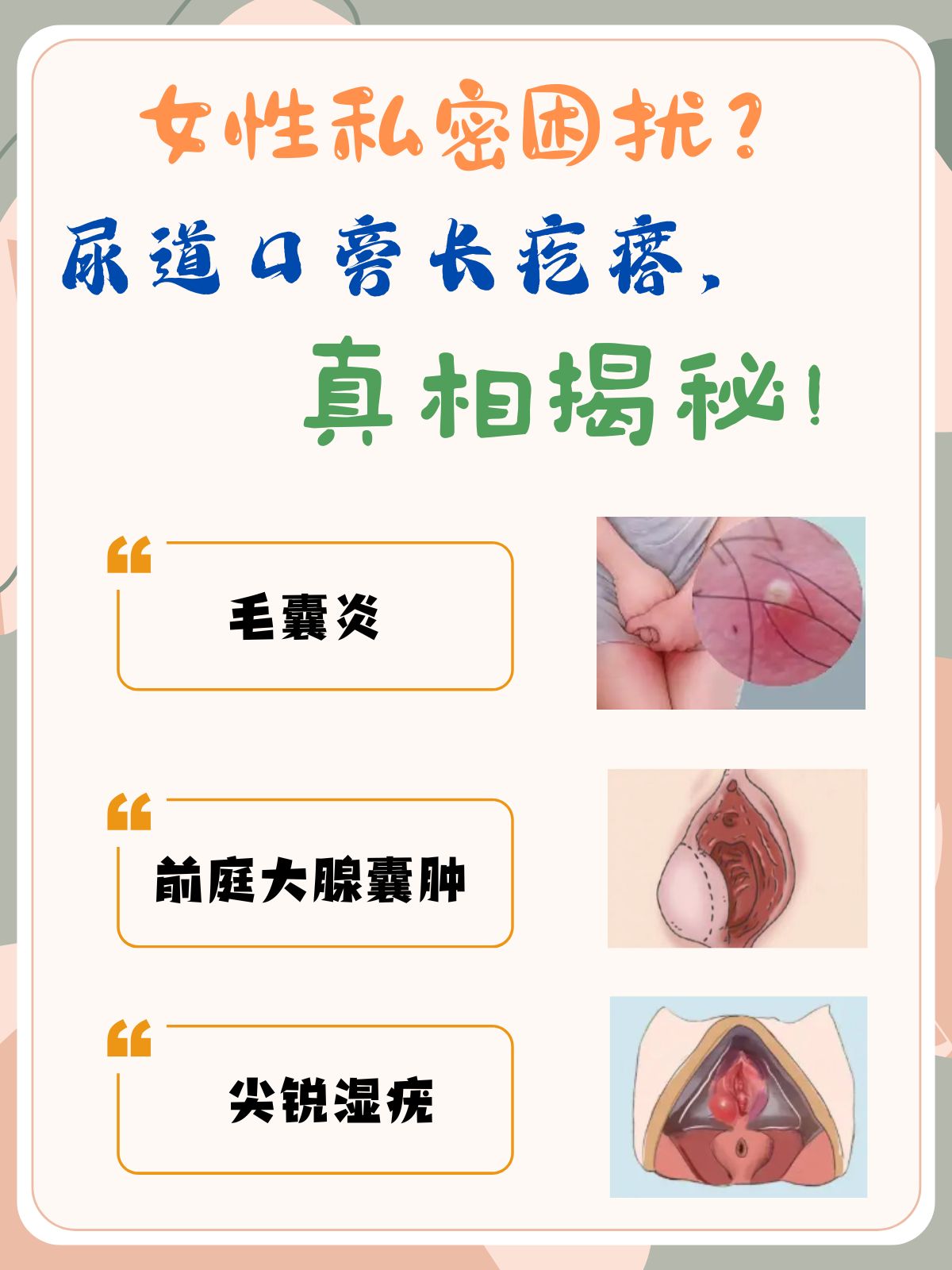 尿道炎症状有哪些