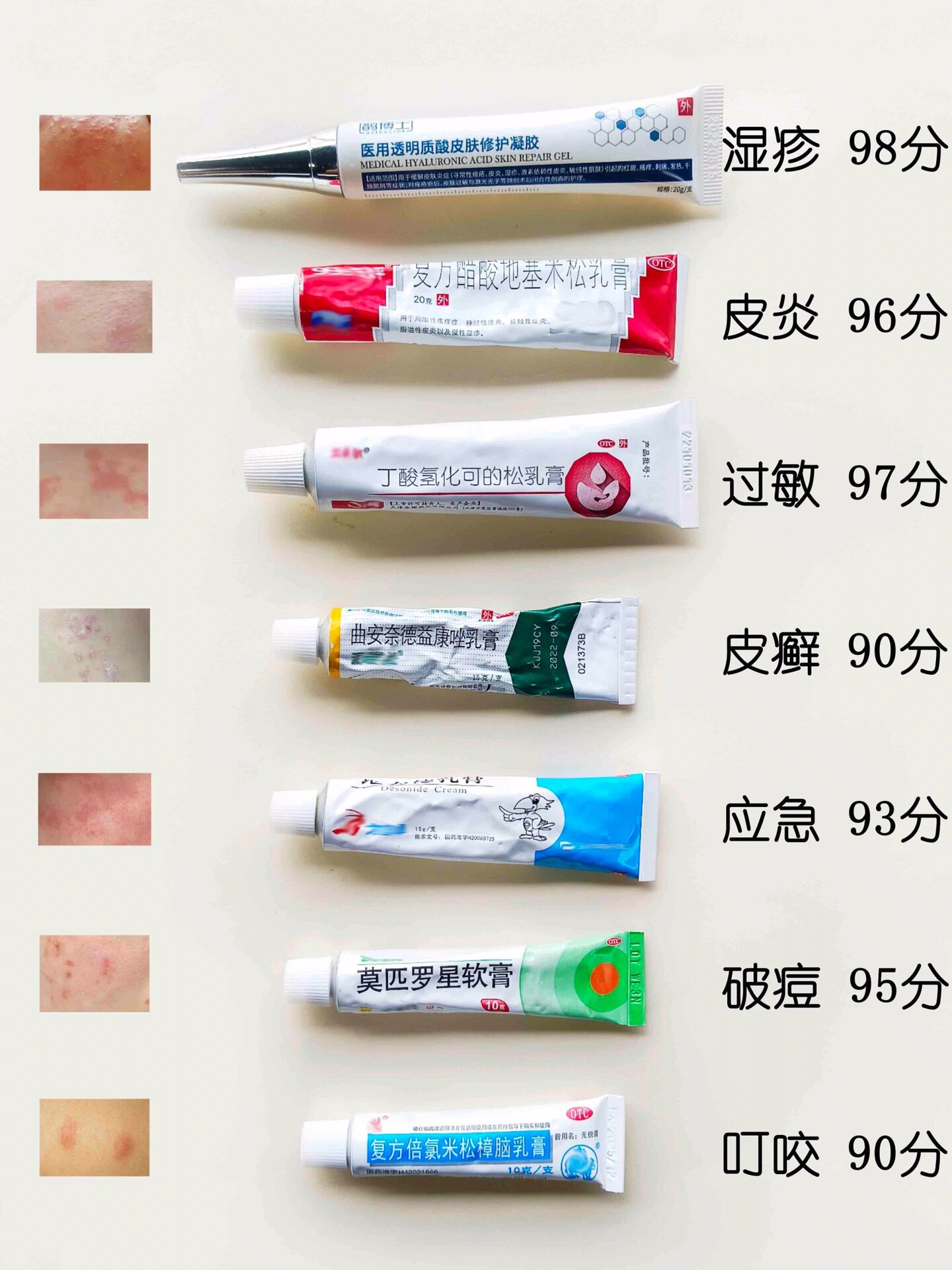 吃芒果过敏用哪种药膏