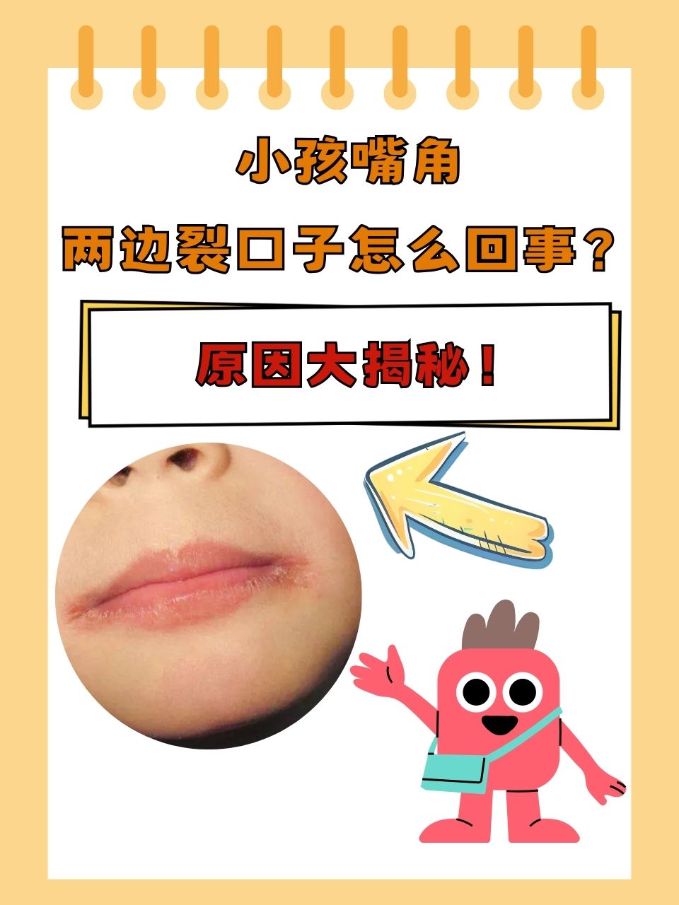 嘴角突然干裂是怎么回事?