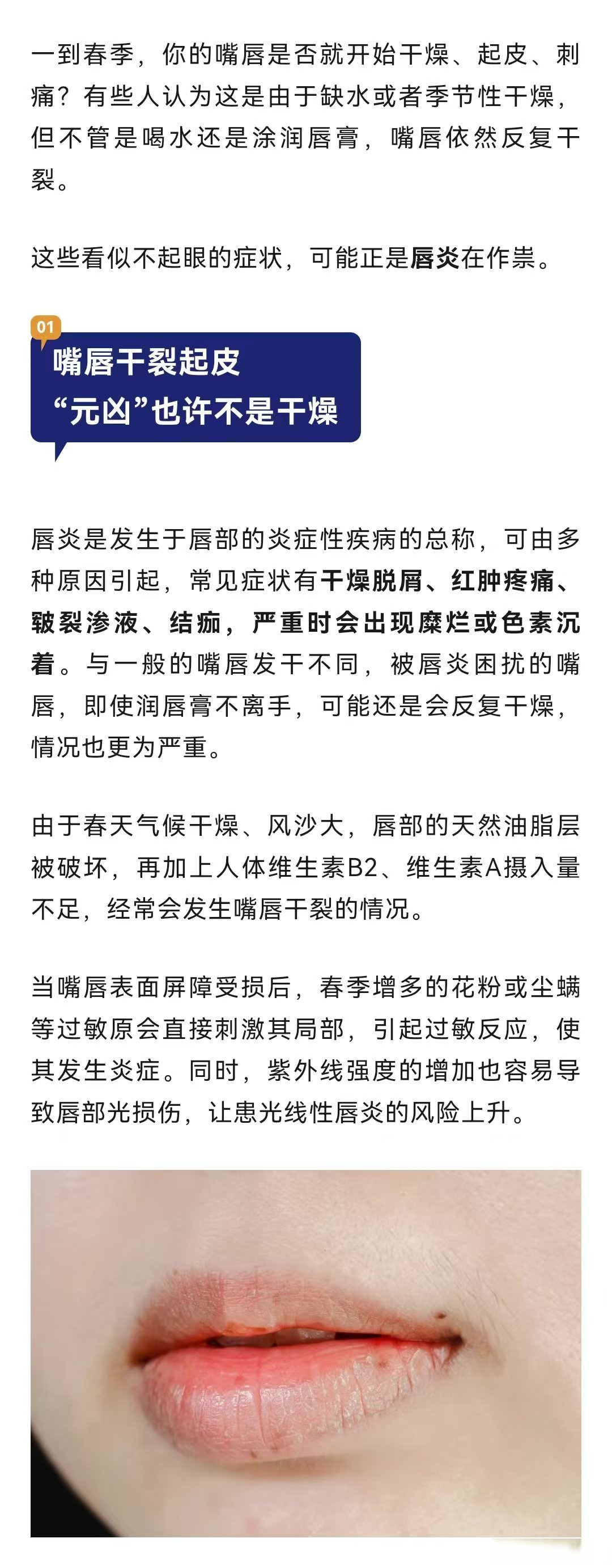 嘴角突然干裂是怎么回事?