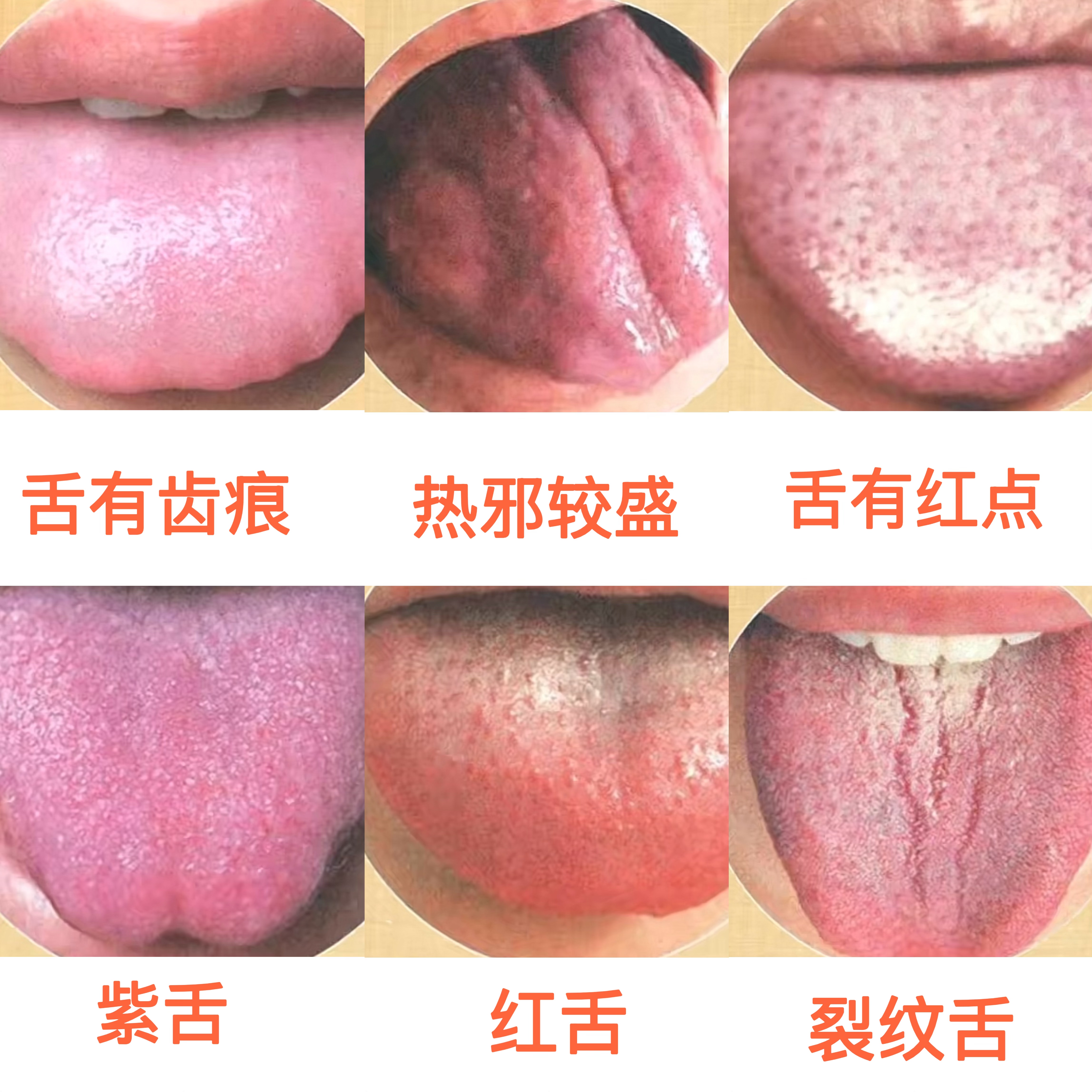 舌苔白有齿痕怎么调理