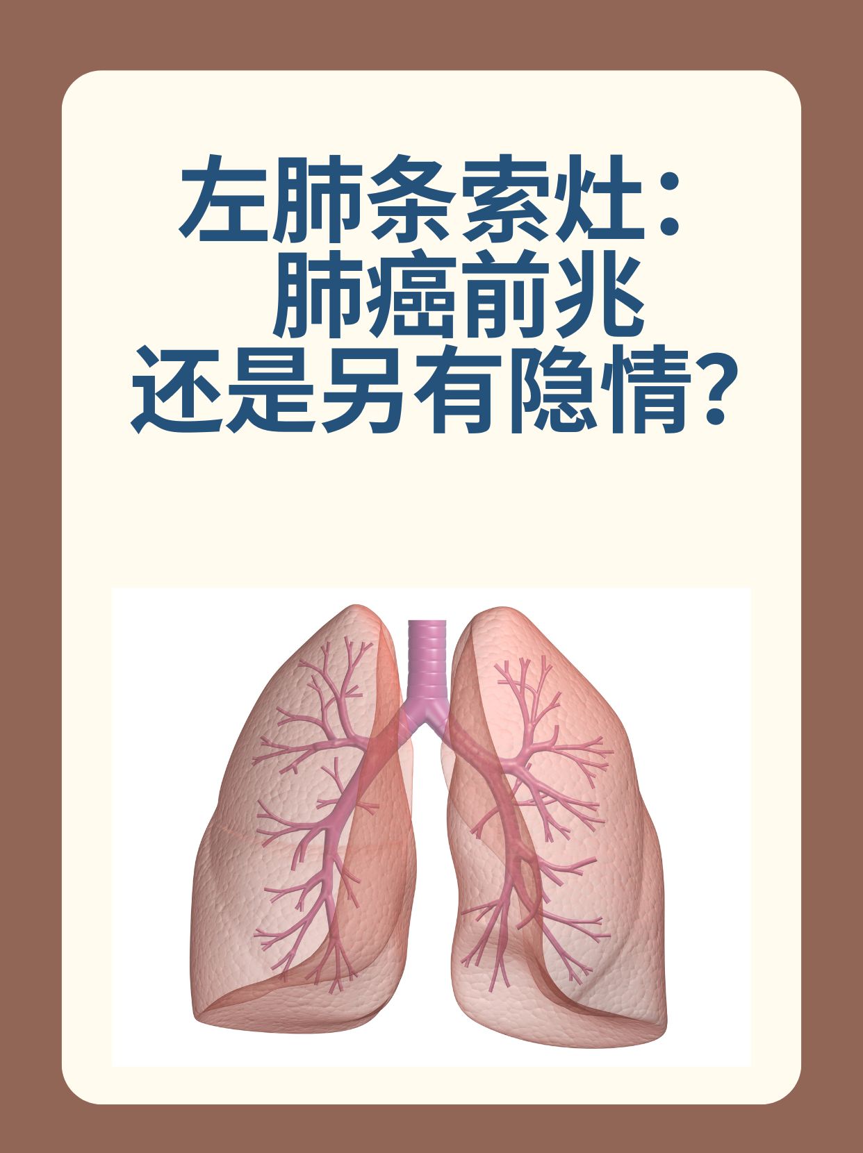 什么是肺癌早期