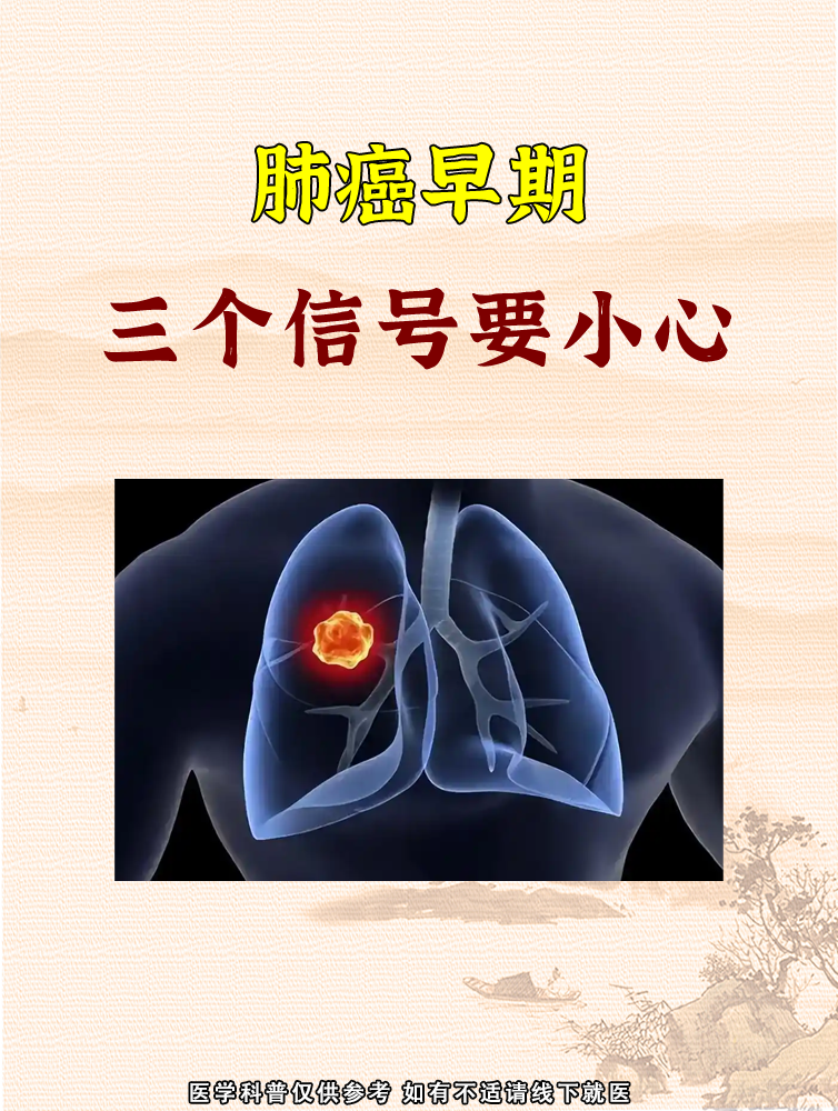 什么是肺癌早期