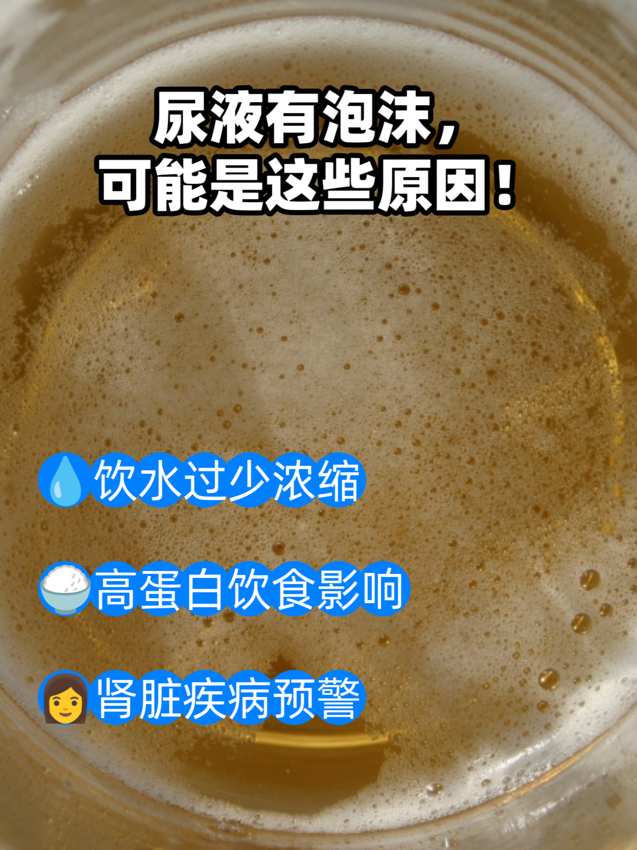 小便有很多泡沫是什么原因