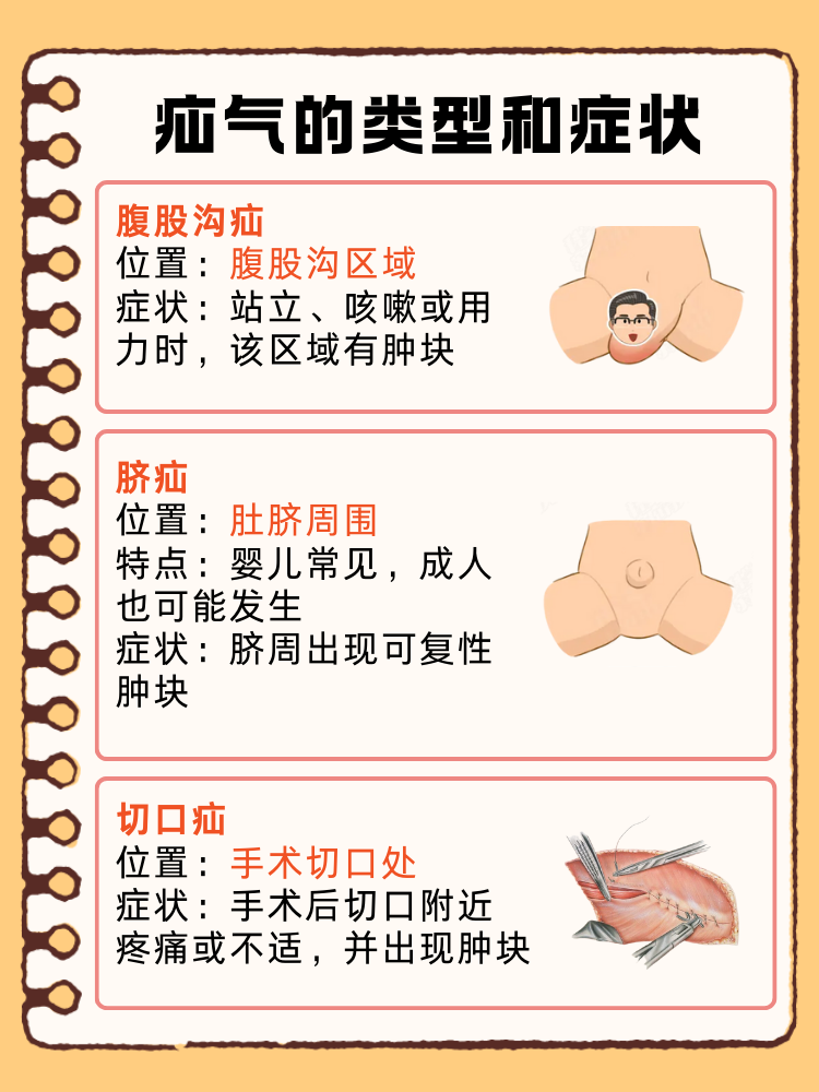 女性疝气的症状及危害