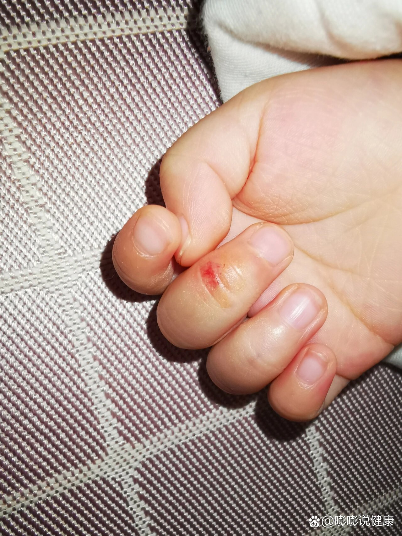 第一次流血了第二次会流血吗?