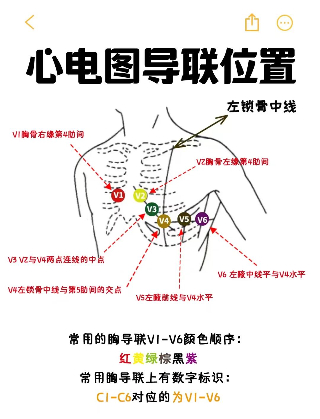 什么是左心室高电压