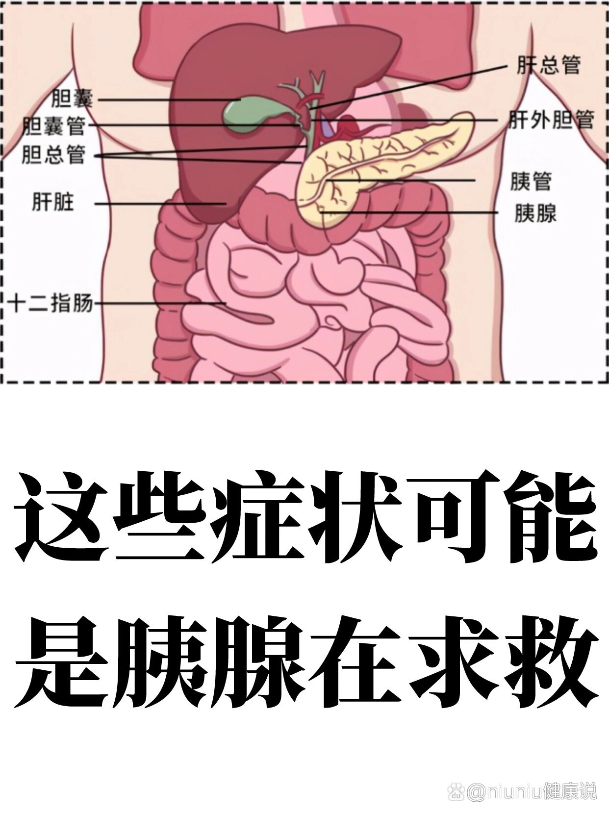 慢性胰腺炎的症状有几种