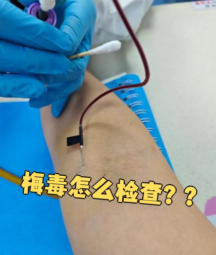 梅毒螺旋体特异抗体测定