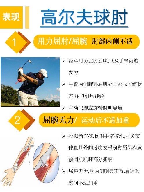 网球肘的症状有哪些