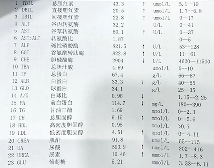 病毒性肝炎有什么症状