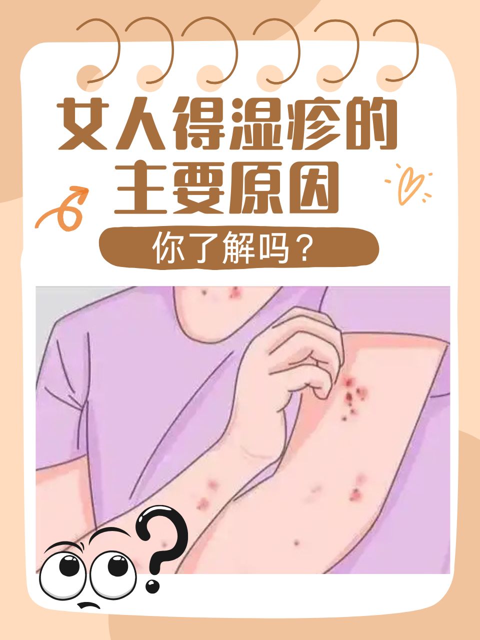 为什么容易得湿疹