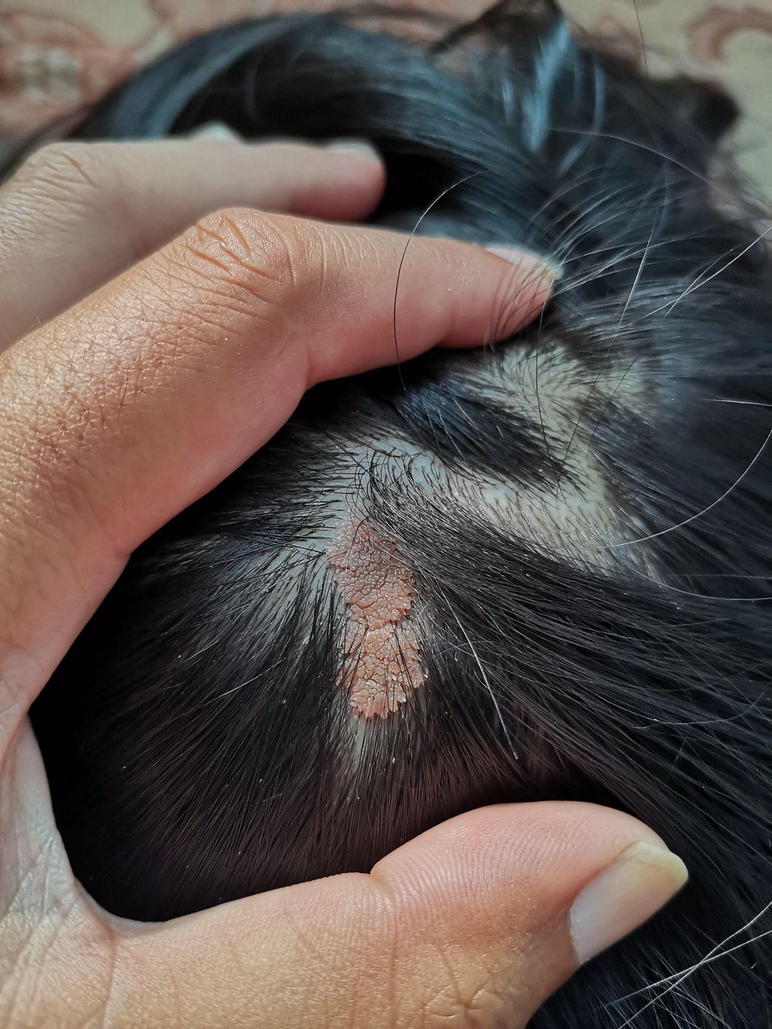 头上长疙瘩怎么回事