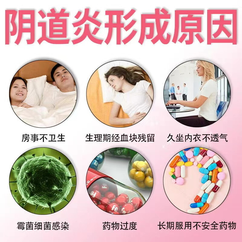 什么是细菌性阴道病?