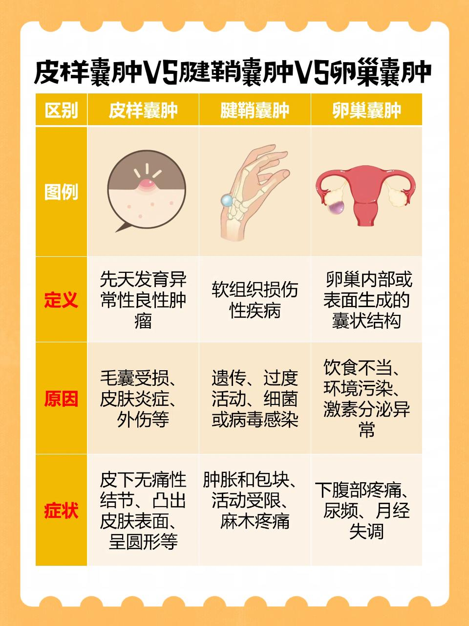 甲状腺囊肿注意什么