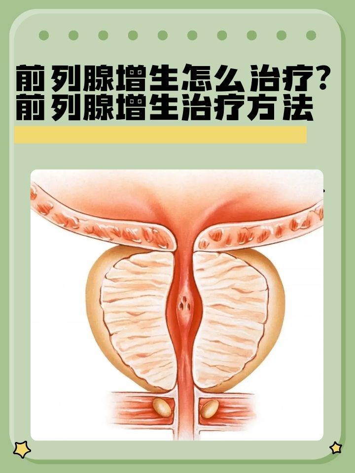 前列腺增大对身体有什么影响