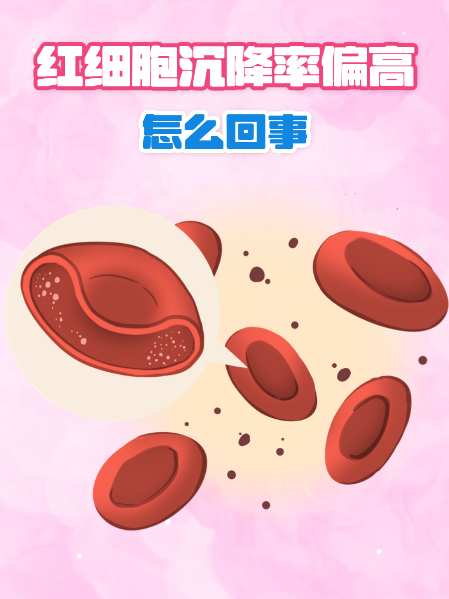 红细胞偏高是什么原因
