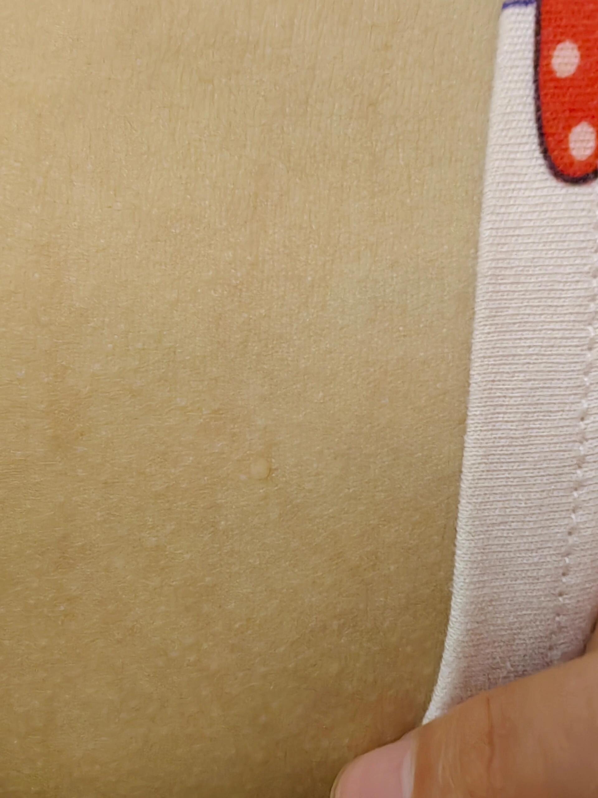 肚皮上小疙瘩,发痒,有图