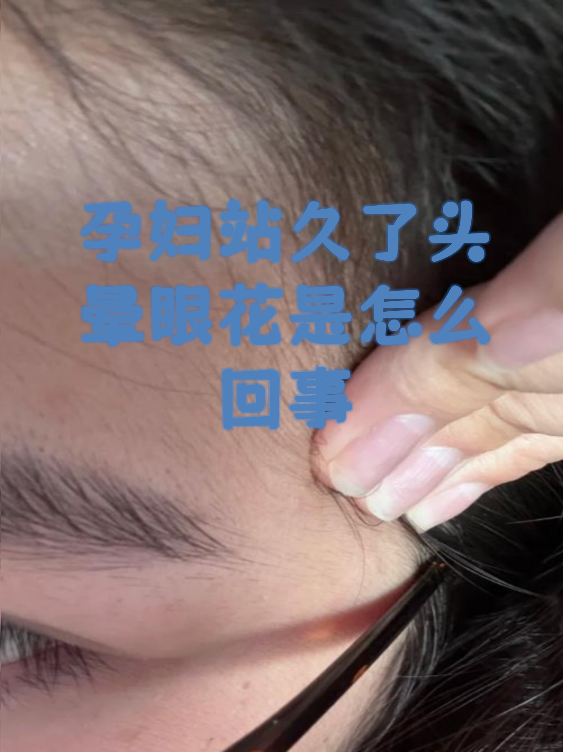 怀孕初期会头晕吗