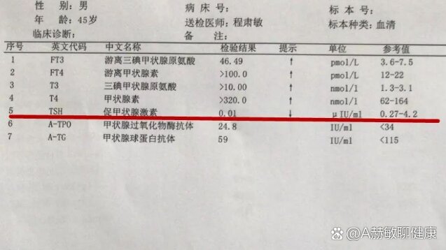 游离甲状腺素ft4高