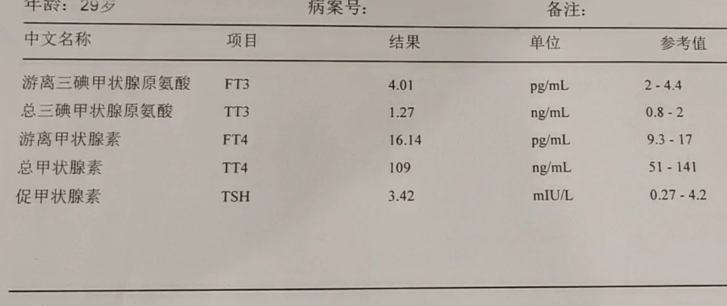 游离甲状腺素ft4高