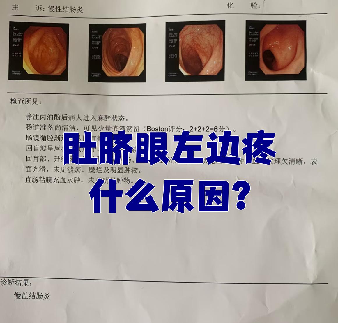 肚脐眼左边疼是怎么回事?