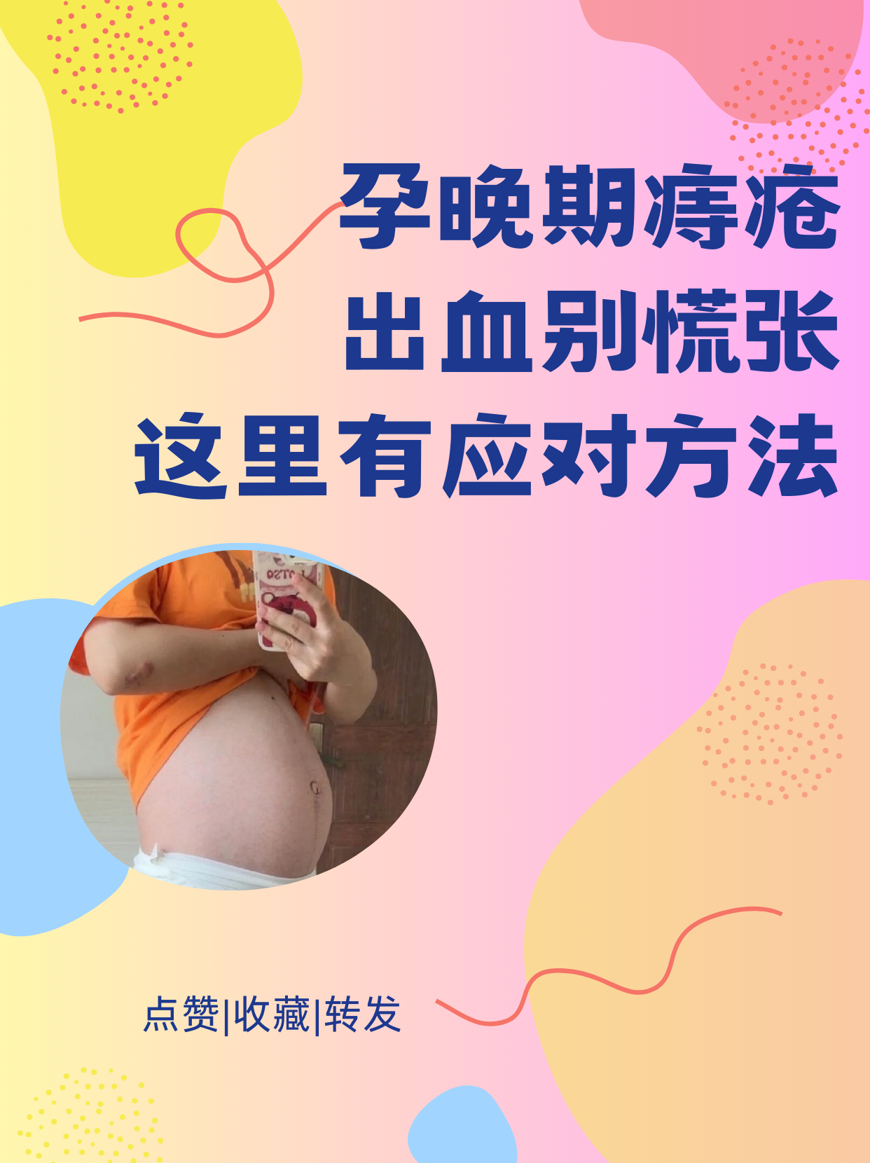 孕妇痔疮膏有哪些,孕痔安可以用吗?