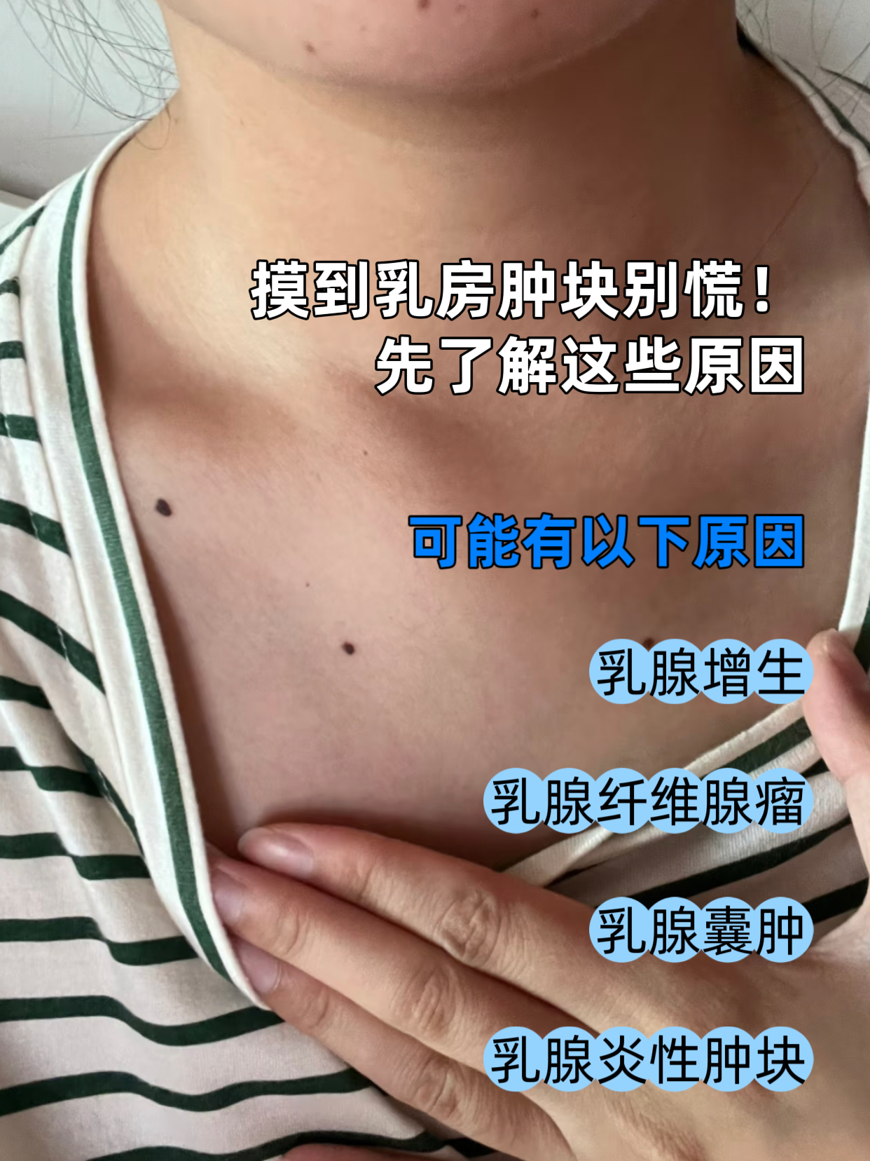 乳腺肿瘤的症状有什么?