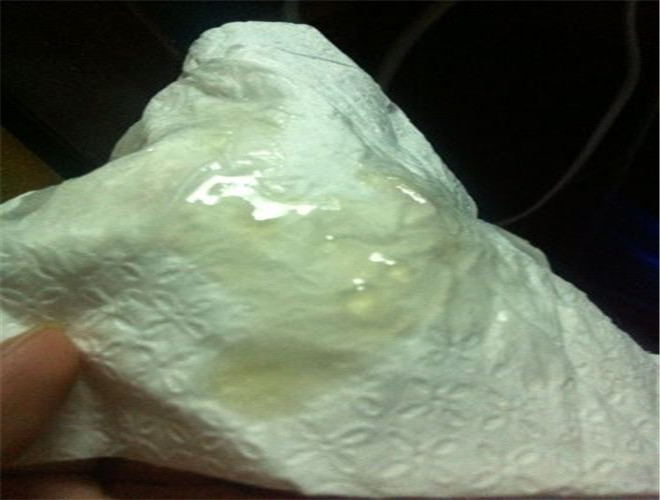 发现卫生纸上有疑似精液