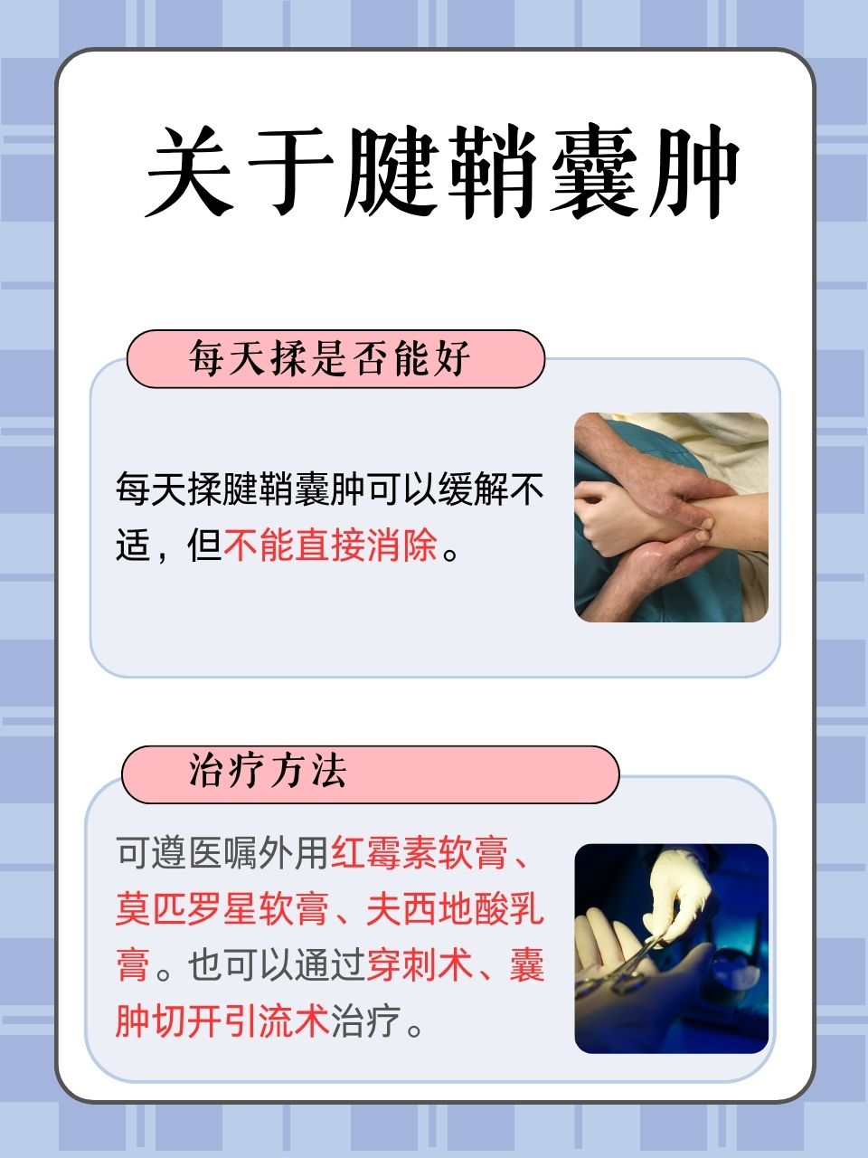 手腕腱鞘囊肿最佳治疗方法