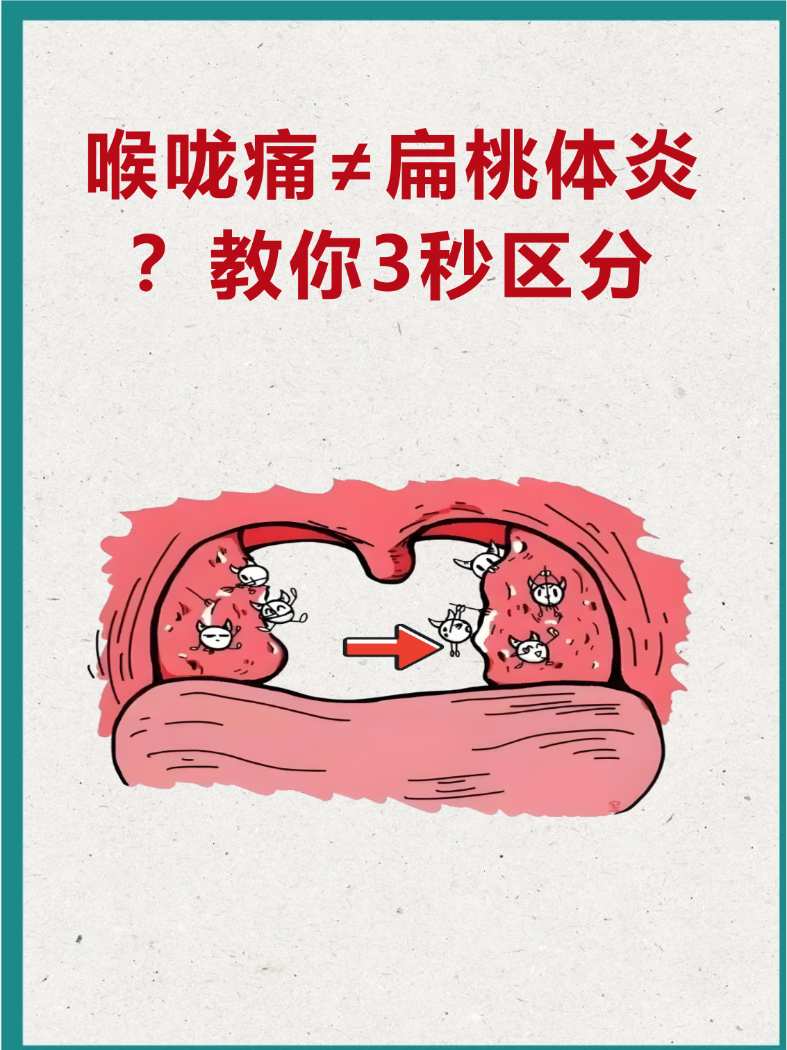 扁桃体炎的主要症状有哪些?