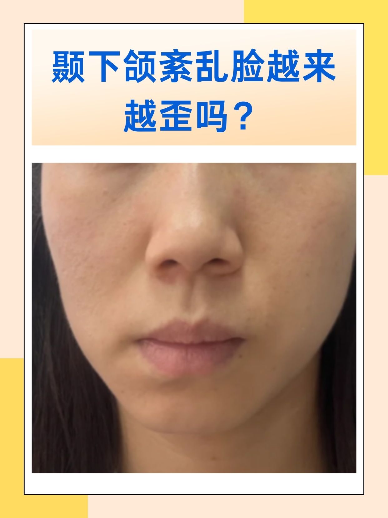 颞下颌关节紊乱为什么会脸变形?