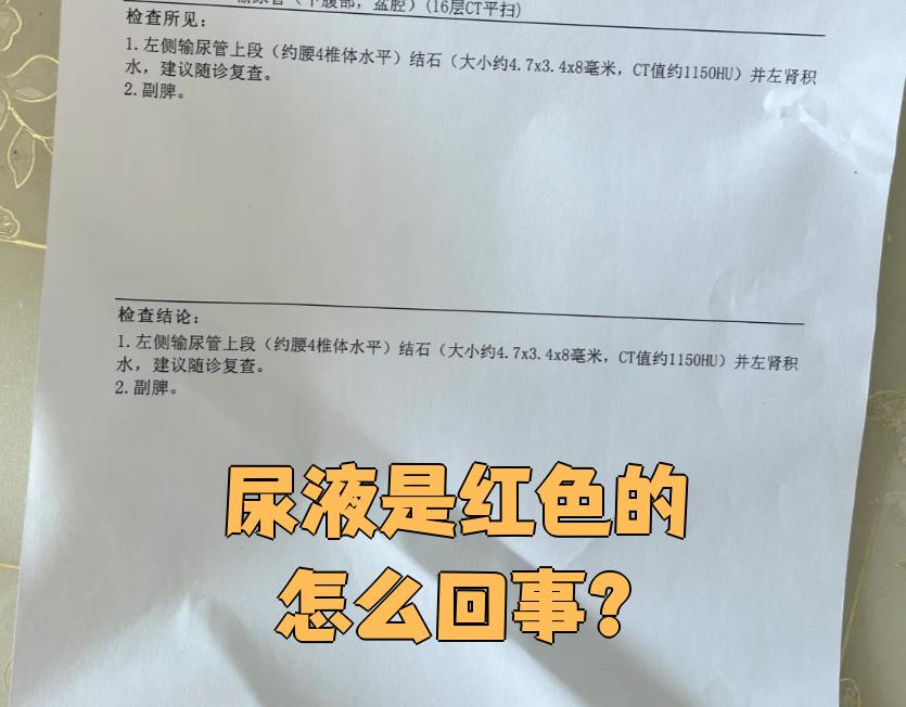 男性尿液发红怎么回事