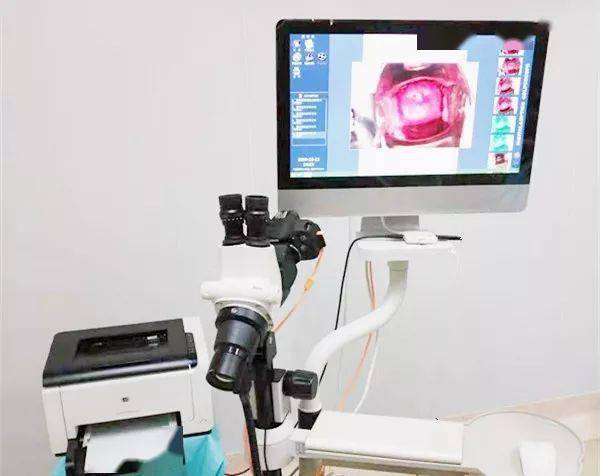 阴道镜检查是什么