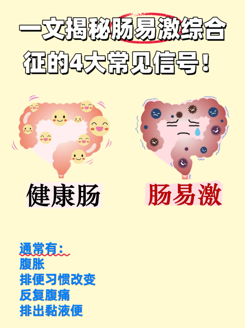 肠易激综合征天天腹痛怎么回事