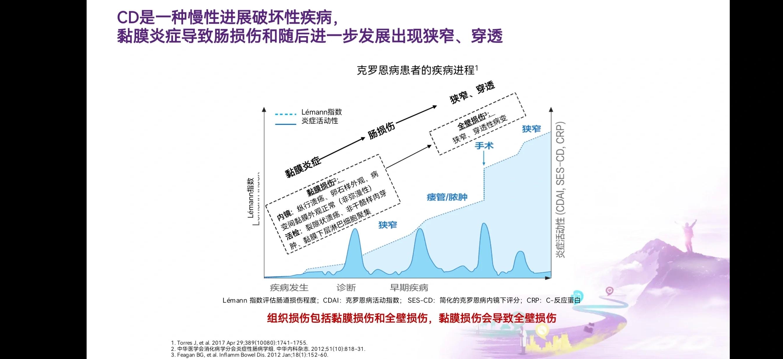 克罗恩病严重吗?