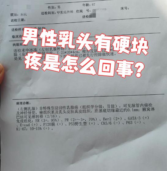 男性乳腺癌有哪些症状?