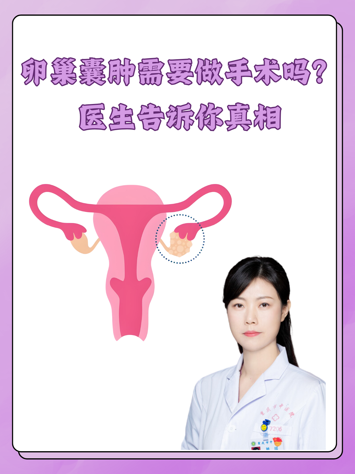 黄体囊肿需要治疗吗