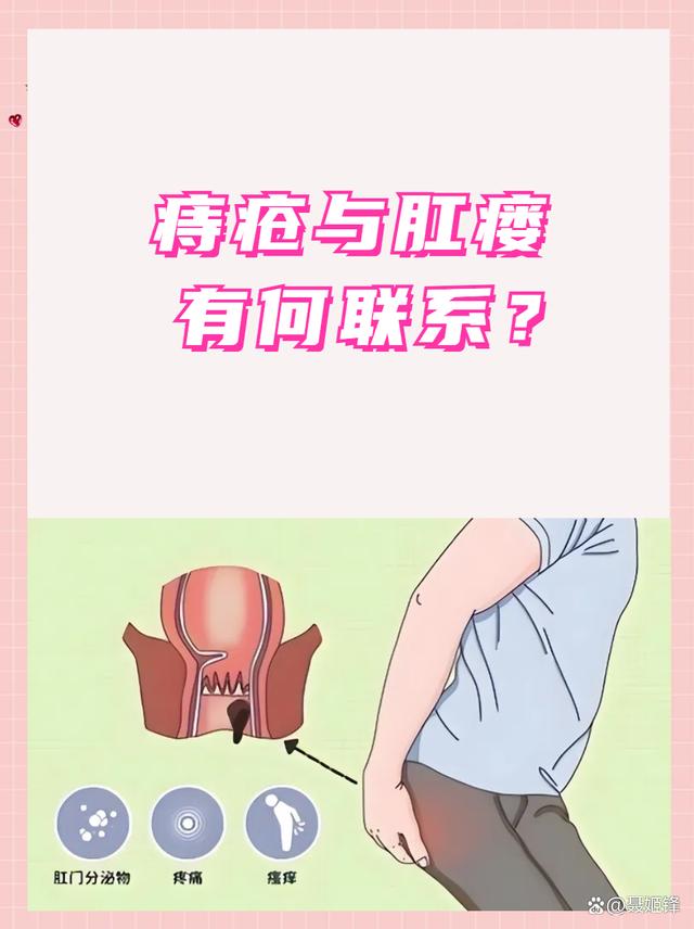 肛瘘和痔疮哪个更严重