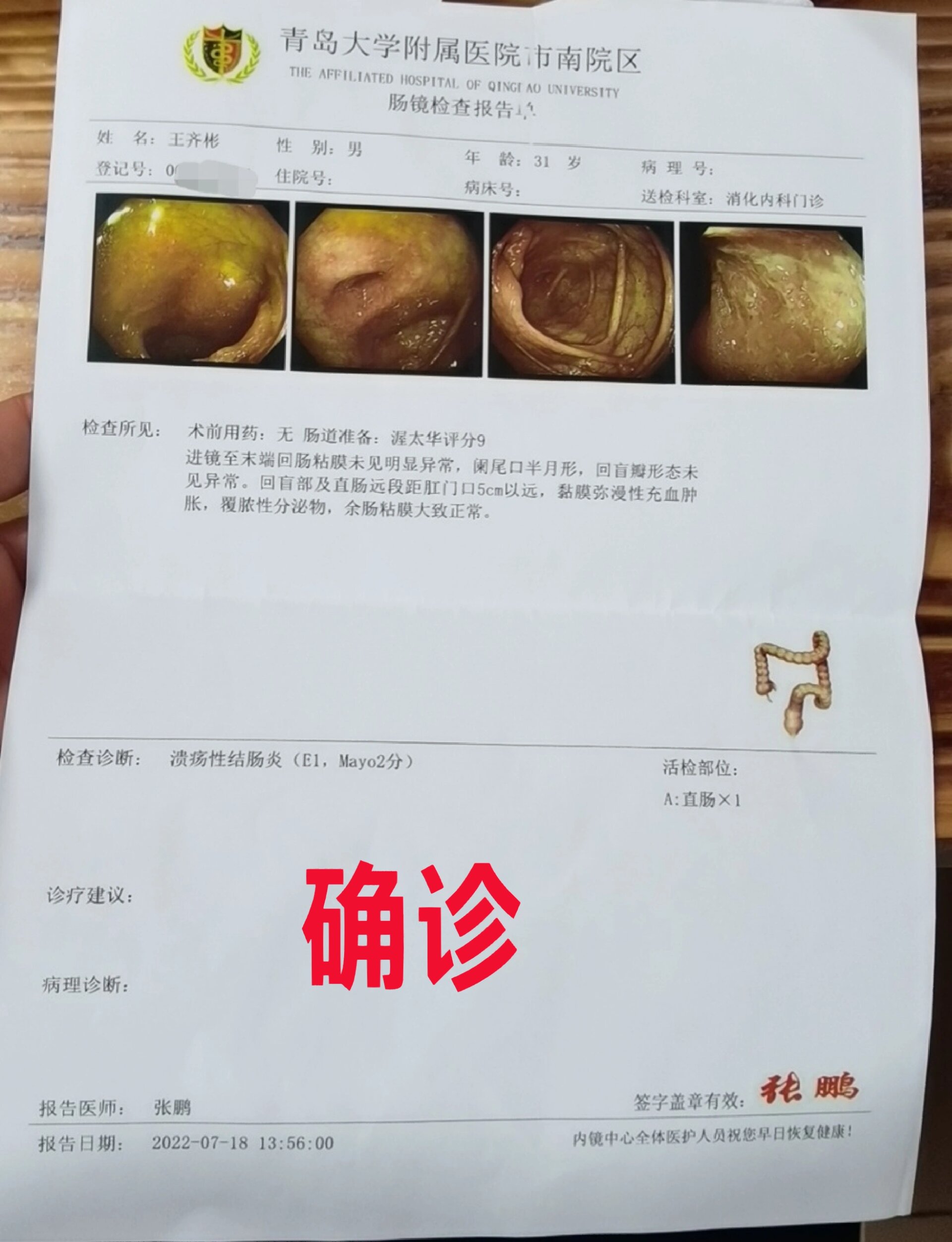 坏死性小肠结肠炎会有哪些表现