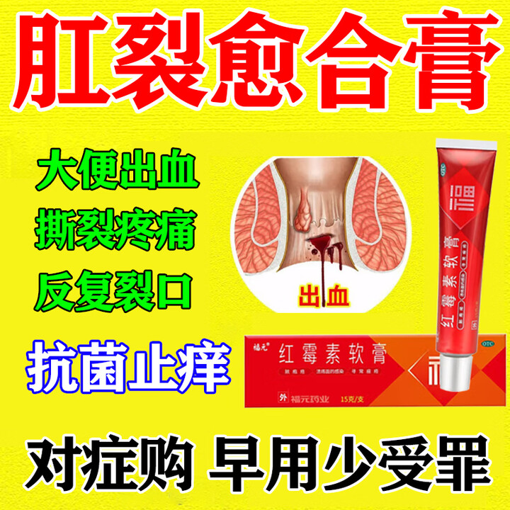 肛裂涂什么药膏比较好?