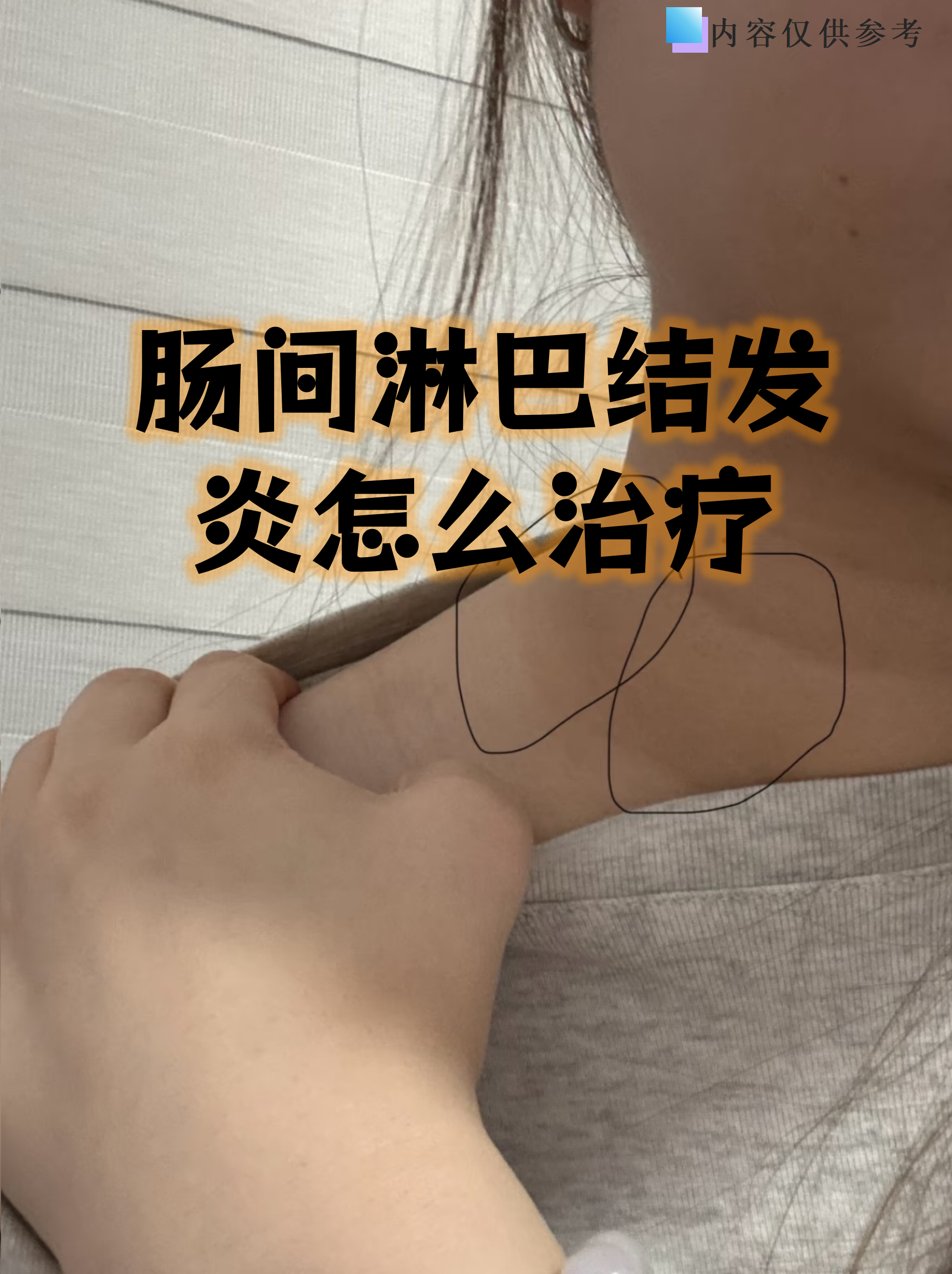 坏死性淋巴结炎怎么治