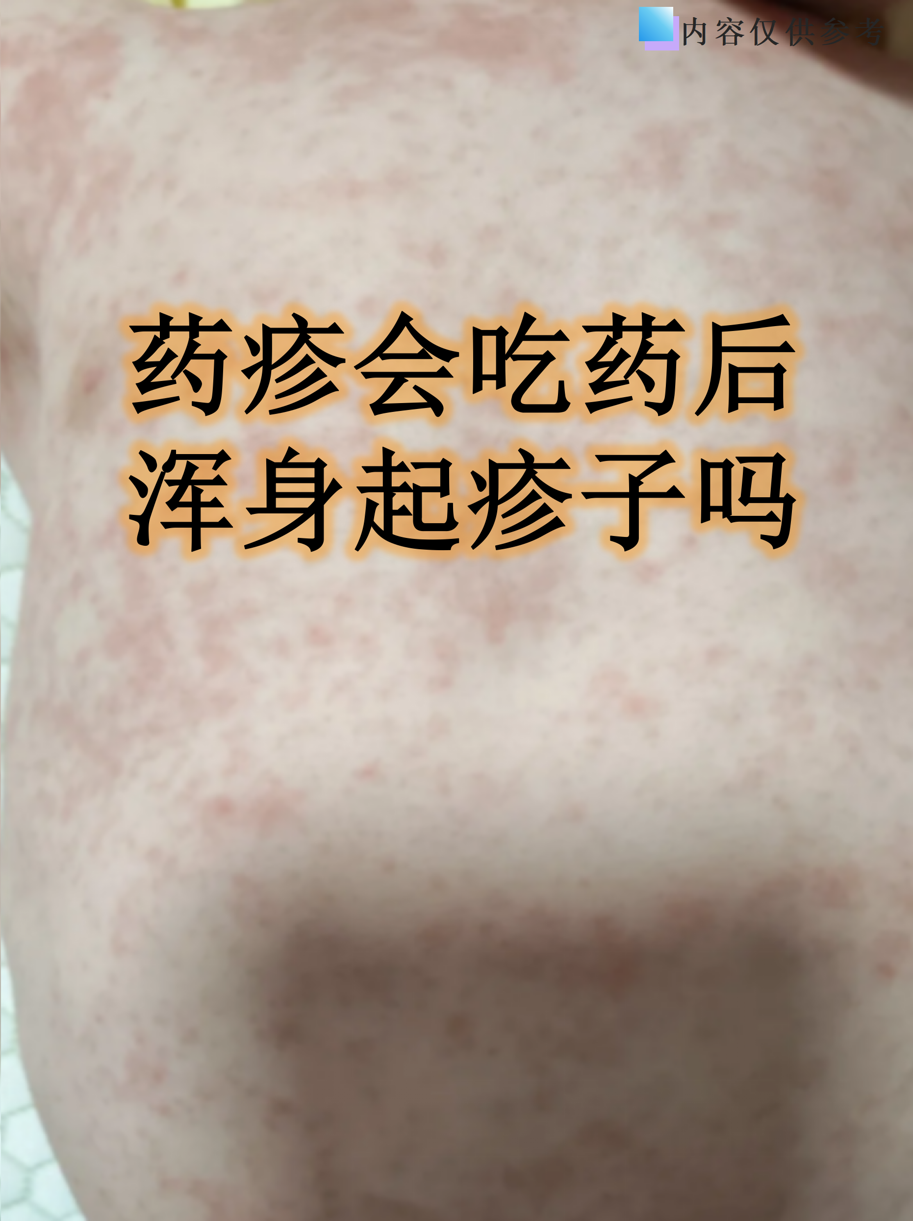 药疹是什么样的呢?