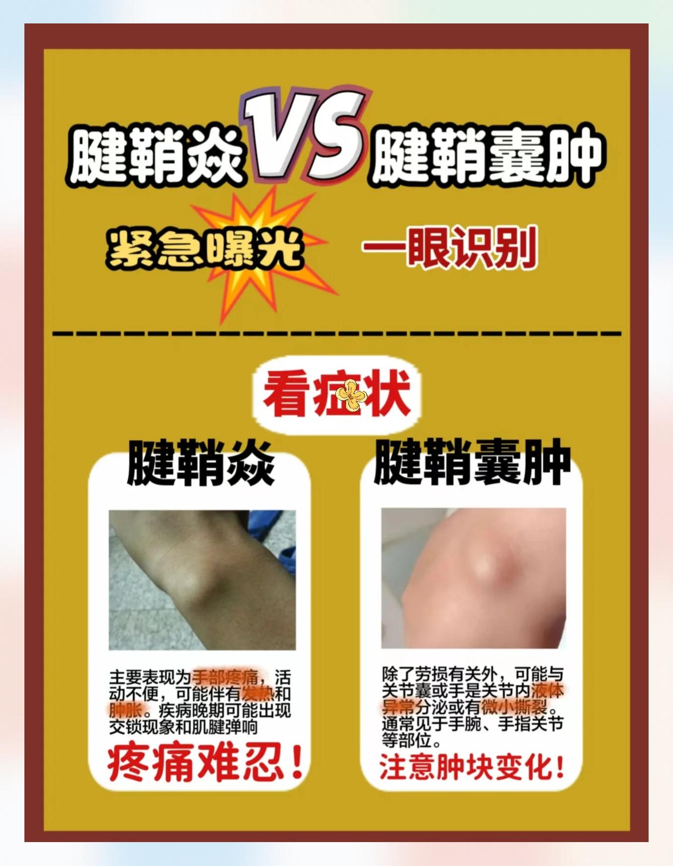 腱鞘炎有什么症状?